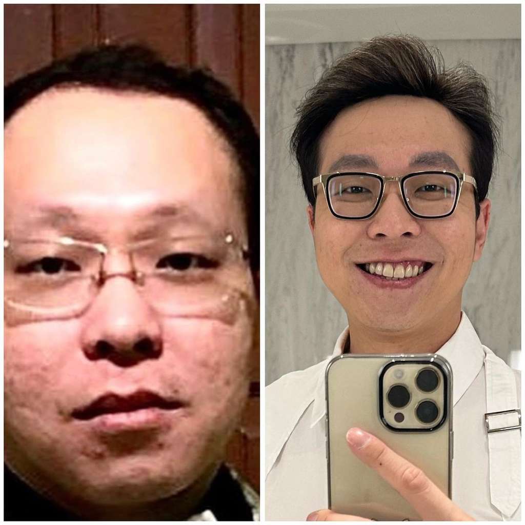 Viral! Foto-Foto `Aib` Dokter Richard Lee Sebelum Kenal Perawatan, Beda Banget, Bak Bumi Langit!
