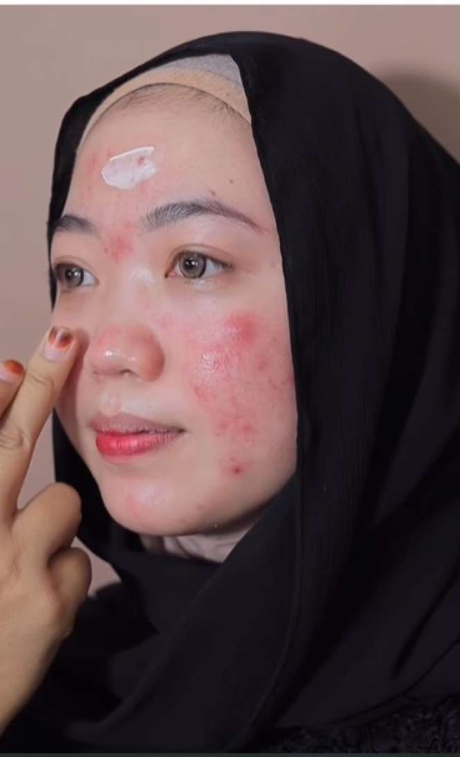 Potret Transformasi Makeup Pengantin dengan Wajah Berjerawat, Hasilnya Bikin Tercengang, Teknik MUA Bukang Kaleng-kaleng!