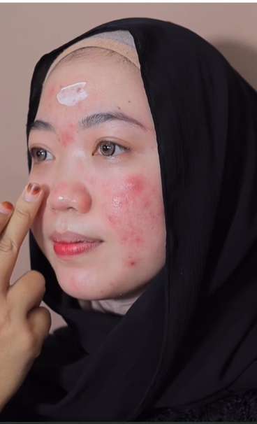 Potret Transformasi Makeup Pengantin dengan Wajah Berjerawat, Hasilnya Bikin Tercengang, Teknik MUA Bukang Kaleng-kaleng!