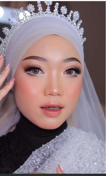 Potret Transformasi Makeup Pengantin dengan Wajah Berjerawat, Hasilnya Bikin Tercengang, Teknik MUA Bukang Kaleng-kaleng!