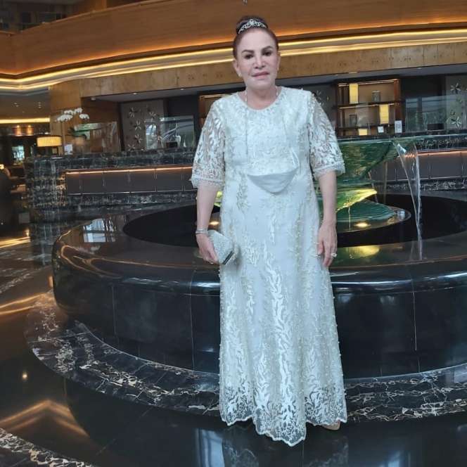 Penampilan Artis Lawas Ini Berubah Drastis Usai Suntik Silikon di Wajah Hingga Pernah Jualan Puding Karena Sepi Job, Begini Kabar Terbarunya