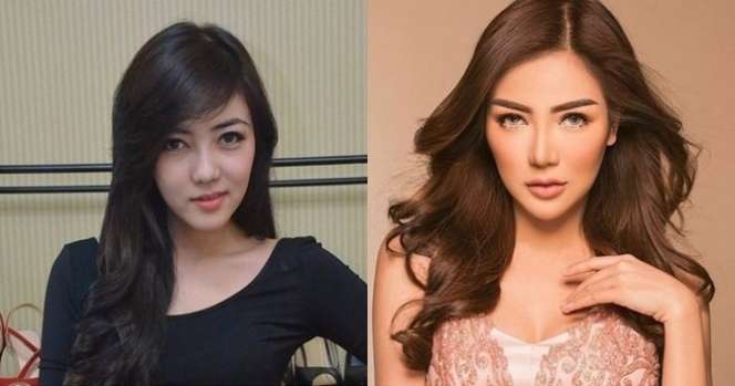 12 Potret Before VS After Artis Lakukan Operasi Hidung, Terbaru Ada Jessica Iskandar, Tuai Cibiran!