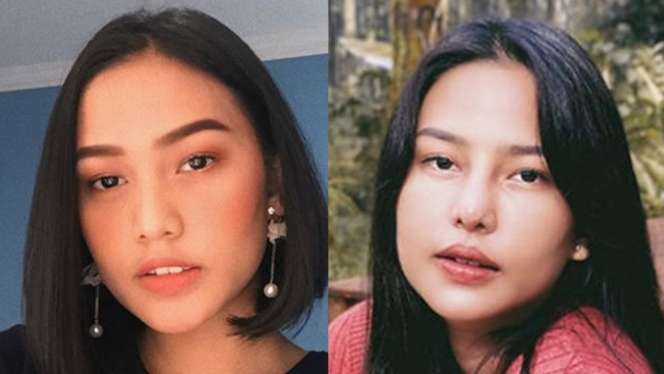 12 Potret Before VS After Artis Lakukan Operasi Hidung, Terbaru Ada Jessica Iskandar, Tuai Cibiran!