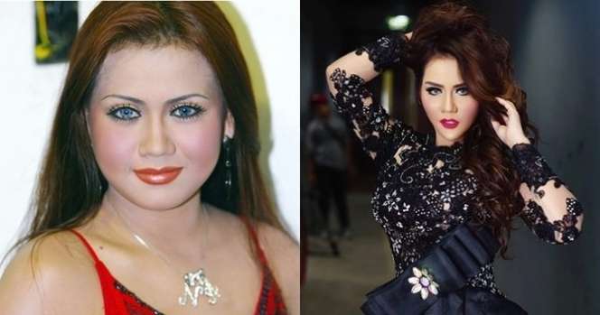 12 Potret Before VS After Artis Lakukan Operasi Hidung, Terbaru Ada Jessica Iskandar, Tuai Cibiran!
