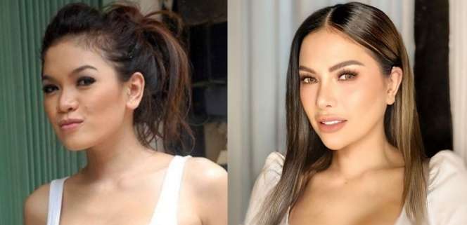 12 Potret Before VS After Artis Lakukan Operasi Hidung, Terbaru Ada Jessica Iskandar, Tuai Cibiran!