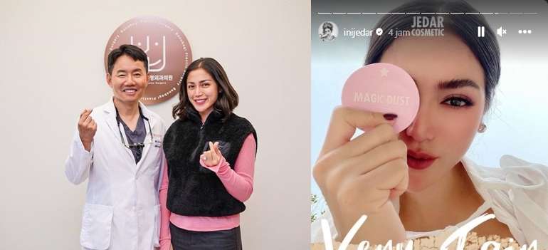 12 Potret Before VS After Artis Lakukan Operasi Hidung, Terbaru Ada Jessica Iskandar, Tuai Cibiran!