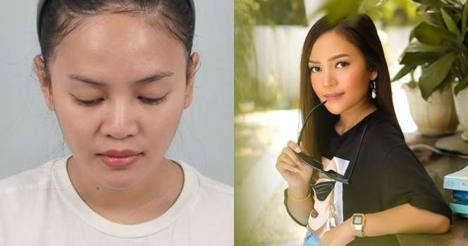 12 Potret Before VS After Artis Lakukan Operasi Hidung, Terbaru Ada Jessica Iskandar, Tuai Cibiran!