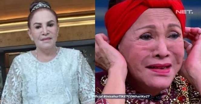 8 Potret Before VS After Artis yang Gagal Lakukan Operasi Plastik, Ada yang Membusuk!