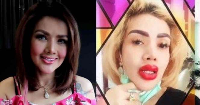 8 Potret Before VS After Artis yang Gagal Lakukan Operasi Plastik, Ada yang Membusuk!