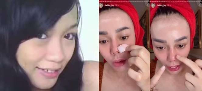 8 Potret Before VS After Artis yang Gagal Lakukan Operasi Plastik, Ada yang Membusuk!