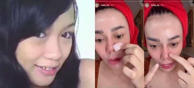 8 Potret Before VS After Artis yang Gagal Lakukan Operasi Plastik, Ada yang Membusuk!
