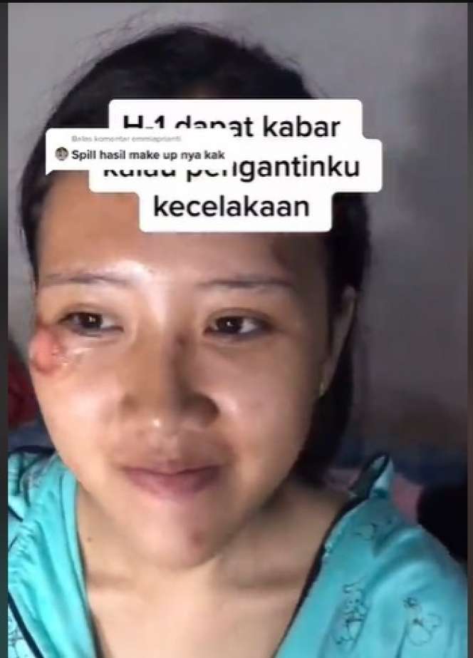 Potret Makeup Pengantin Usai Alami Kecelakaan, Hasilnya Malah di Luar Dugaan, MUA Auto Panik!