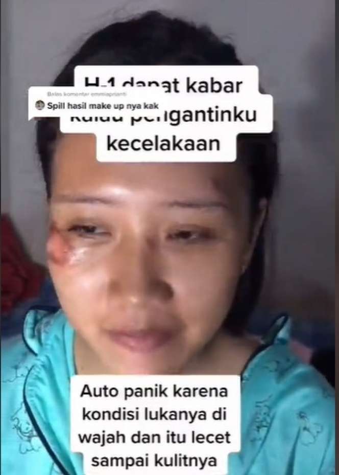 Potret Makeup Pengantin Usai Alami Kecelakaan, Hasilnya Malah di Luar Dugaan, MUA Auto Panik!