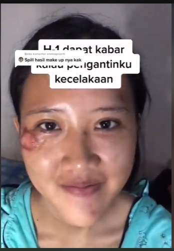 Potret Makeup Pengantin Usai Alami Kecelakaan, Hasilnya Malah di Luar Dugaan, MUA Auto Panik!
