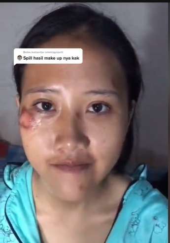 Potret Makeup Pengantin Usai Alami Kecelakaan, Hasilnya Malah di Luar Dugaan, MUA Auto Panik!