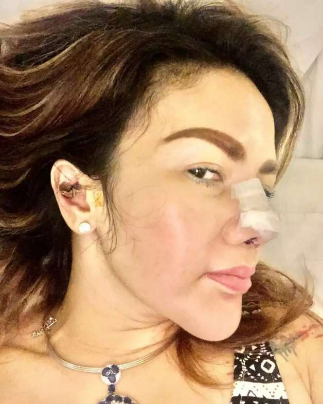 Ingat Ijah, ART Gemuk di Sinetron Bidadari? Kini Jadi Artis Kontroversial, Tubuh Kurus Wajahnya Berubah Usai Operasi Plastik