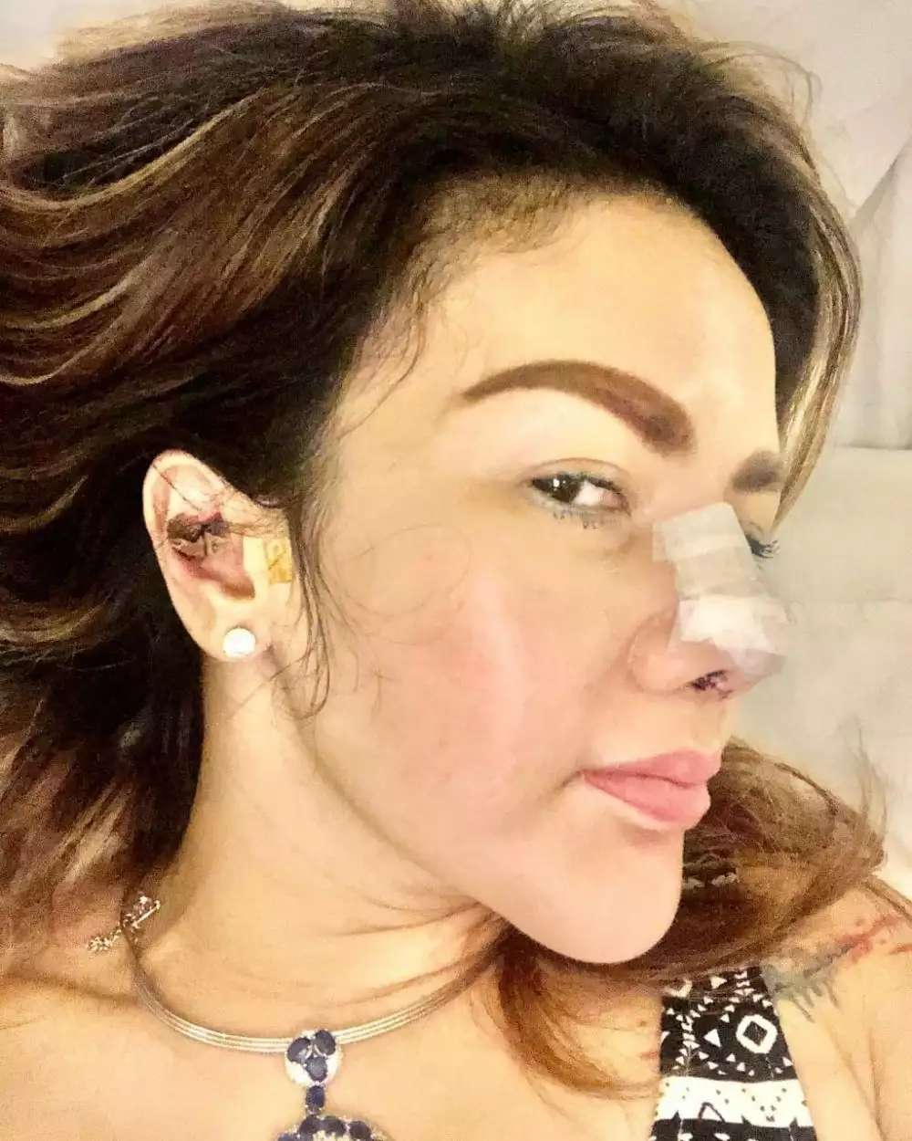 Ingat Ijah, ART Gemuk di Sinetron Bidadari? Kini Jadi Artis Kontroversial, Tubuh Kurus Wajahnya Berubah Usai Operasi Plastik