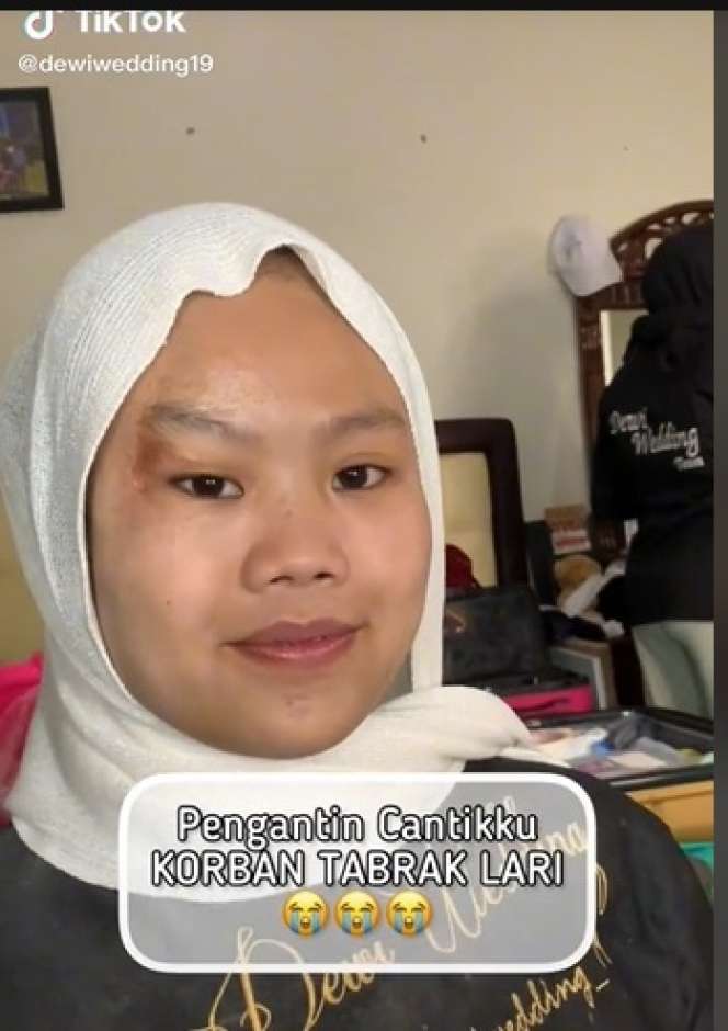 Potret Makeup Pengantin Korban Tabrak Lari, Awalnya Bikin MUA Panik, Hasilnya Malah Bikin Salfok!