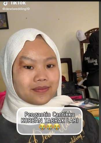Potret Makeup Pengantin Korban Tabrak Lari, Awalnya Bikin MUA Panik, Hasilnya Malah Bikin Salfok!