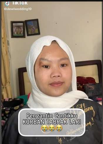 Potret Makeup Pengantin Korban Tabrak Lari, Awalnya Bikin MUA Panik, Hasilnya Malah Bikin Salfok!