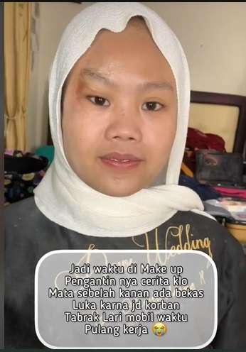 Potret Makeup Pengantin Korban Tabrak Lari, Awalnya Bikin MUA Panik, Hasilnya Malah Bikin Salfok!