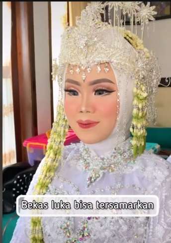 Potret Makeup Pengantin Korban Tabrak Lari, Awalnya Bikin MUA Panik, Hasilnya Malah Bikin Salfok!