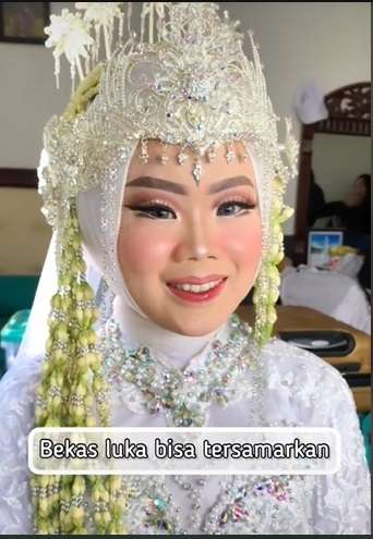 Potret Makeup Pengantin Korban Tabrak Lari, Awalnya Bikin MUA Panik, Hasilnya Malah Bikin Salfok!