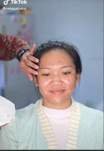 Pengantin Wajah Berjerawat Ini Berhasil Dirias Manglingi, Ternyata Ini Rahasia Sang MUA…