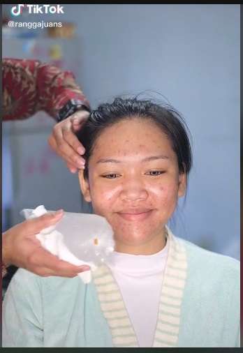 Pengantin Wajah Berjerawat Ini Berhasil Dirias Manglingi, Ternyata Ini Rahasia Sang MUA…