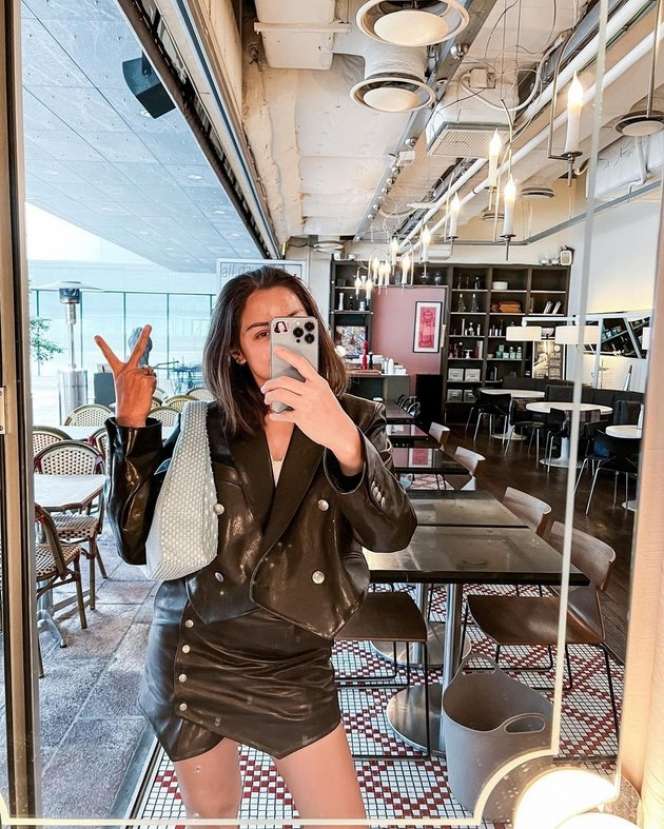 7 Potret Jessica Iskandar Pamer Hidung Baru Usai Oplas, Netizen : Beda Banget Kayak Bukan Jedar!
