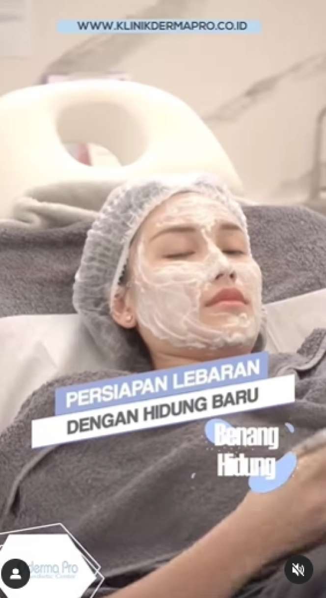 Adu Potret Ayu Ting Ting VS Jessica Iskandar yang Sama-sama Lakukan Perbaikan Bentuk Hidung, Penampilan Barunya Ramai Tuai Cibiran!