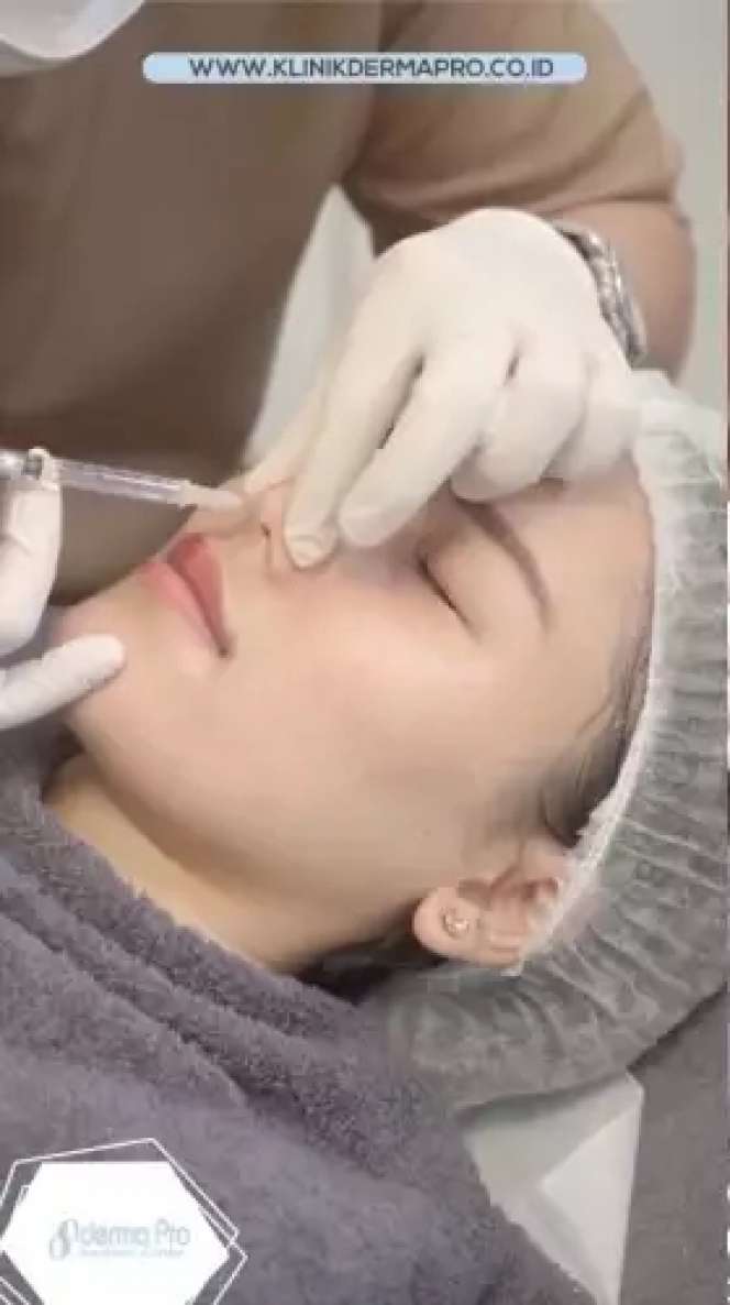 Adu Potret Ayu Ting Ting VS Jessica Iskandar yang Sama-sama Lakukan Perbaikan Bentuk Hidung, Penampilan Barunya Ramai Tuai Cibiran!