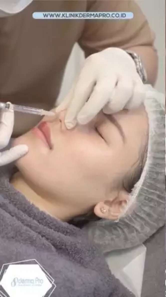Adu Potret Ayu Ting Ting VS Jessica Iskandar yang Sama-sama Lakukan Perbaikan Bentuk Hidung, Penampilan Barunya Ramai Tuai Cibiran!