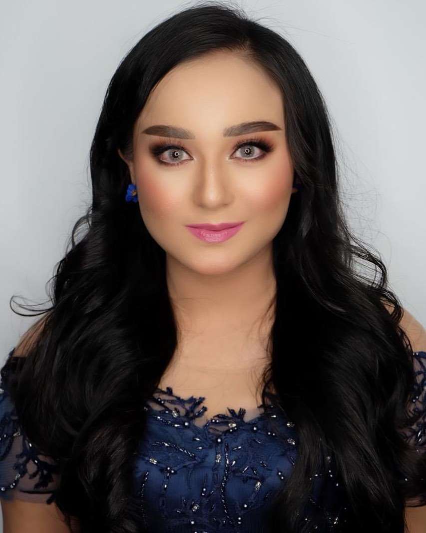 Pernikahan Artis Cantik Ini Dulu Tak Direstui Ibu Hingga Sempat Koma Usai Diet Ketat, Kini Hidupnya Berubah Drastis!