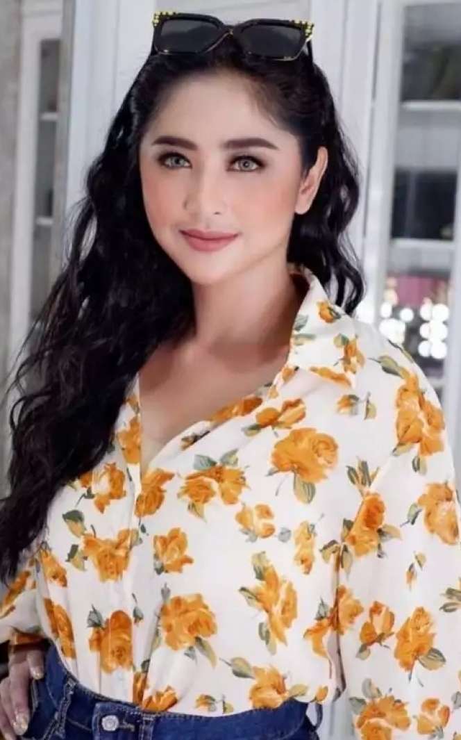 8 Potret Dewi Perssik Sebelum VS Sesudah Oplas, Wajah Bengkak & Lebih Berisi, Tuai Pro Kontra!
