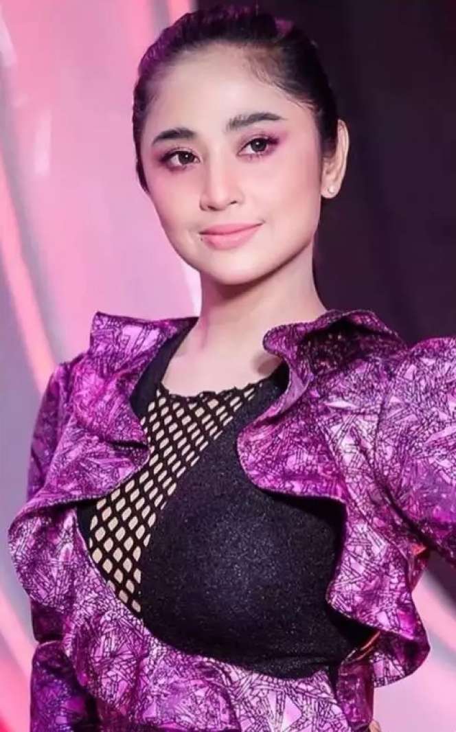 8 Potret Dewi Perssik Sebelum VS Sesudah Oplas, Wajah Bengkak & Lebih Berisi, Tuai Pro Kontra!