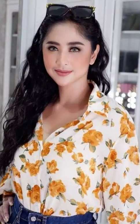 8 Potret Dewi Perssik Sebelum VS Sesudah Oplas, Wajah Bengkak & Lebih Berisi, Tuai Pro Kontra!