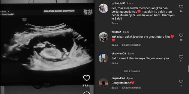 10 Potret Jennifer Coppen Mendadak Umumkan Hamil, Perut Sudah Besar, Netizen Syok: Kapan Nikahnya?