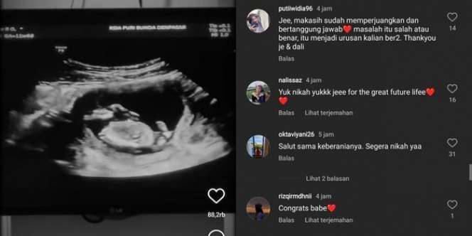 10 Potret Jennifer Coppen Mendadak Umumkan Hamil, Perut Sudah Besar, Netizen Syok: Kapan Nikahnya?