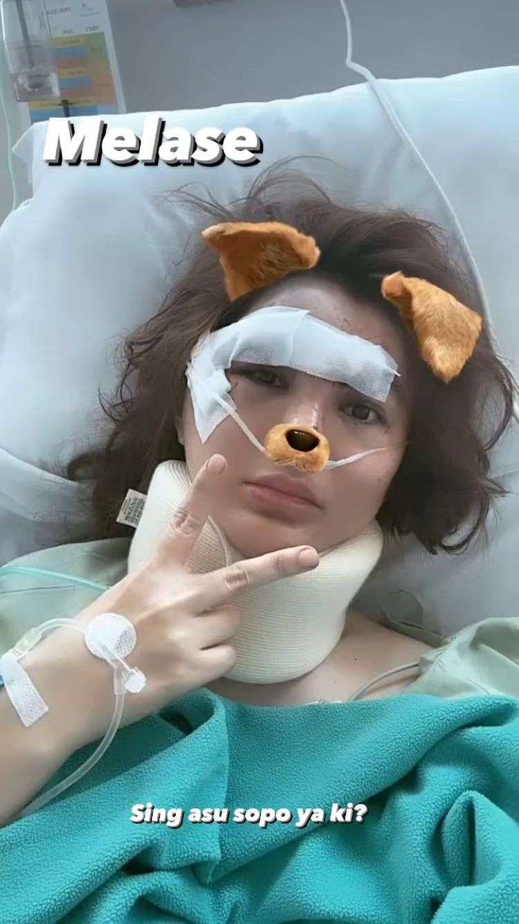 10 Potret Terkini Angela Lee Usai Alami Kecelakaan Hebat di Tol Semarang, Kondisi Mobil Hancur Parah!