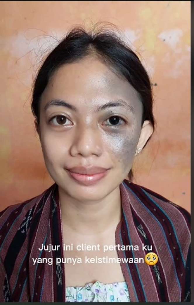 Ingin Tampil Sempurna di Momen Wisuda, Wanita Berwajah Istimewa Ini Pilih MUA Terbaik, Hasilnya Malah Bikin Nangis!