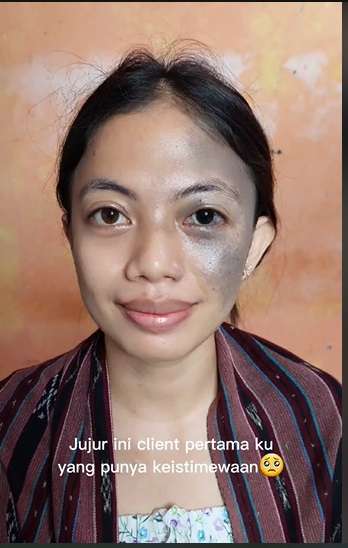 Ingin Tampil Sempurna di Momen Wisuda, Wanita Berwajah Istimewa Ini Pilih MUA Terbaik, Hasilnya Malah Bikin Nangis!