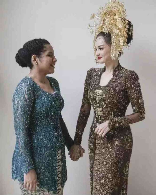 Potret Kedekatan Enzy Storia dengan Sang Adik Casey yang Jarang Tersorot, Disebut Penyelamat Hidup