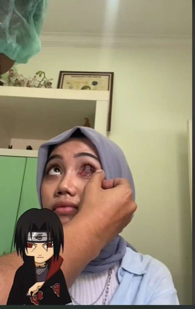 Wanita Ini Pasang Mata Sharingan ala Anime Naruto, Ternyata Ada Kisah Haru Dibaliknya, Netizen: `Berdamai dengan Diri Sendiri`
