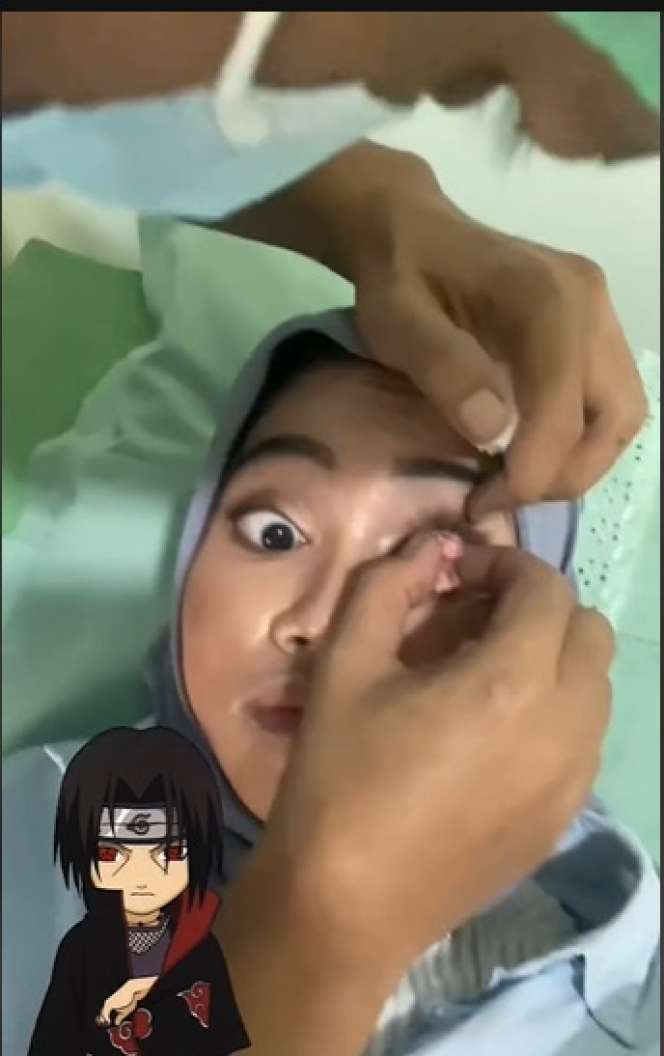 Wanita Ini Pasang Mata Sharingan ala Anime Naruto, Ternyata Ada Kisah Haru Dibaliknya, Netizen: `Berdamai dengan Diri Sendiri`