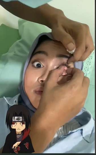 Wanita Ini Pasang Mata Sharingan ala Anime Naruto, Ternyata Ada Kisah Haru Dibaliknya, Netizen: `Berdamai dengan Diri Sendiri`