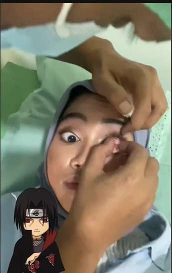 Wanita Ini Pasang Mata Sharingan ala Anime Naruto, Ternyata Ada Kisah Haru Dibaliknya, Netizen: `Berdamai dengan Diri Sendiri`