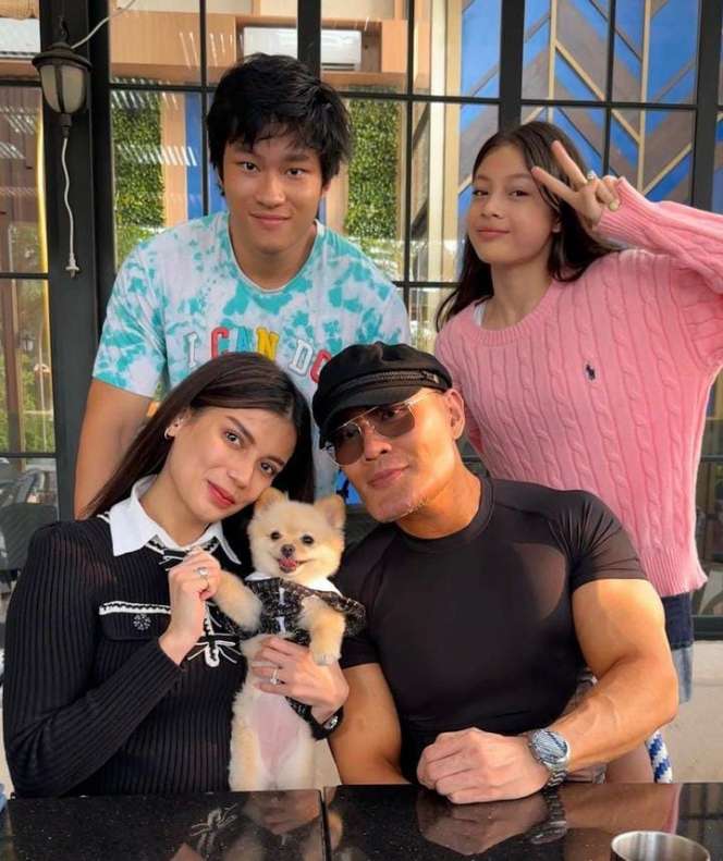 Potret Bentuk Dagu Deddy Corbuzier yang Berubah Drastis, Gegara Suntik Stem Sell dari Tali Pusar Bayi