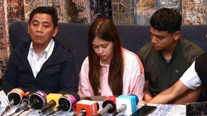 Potret Rebecca Klopper Muncul Pertama Kali usai Video Syur 47 Detik Miripnya Viral: Minta Maaf, Tertunduk Lesu