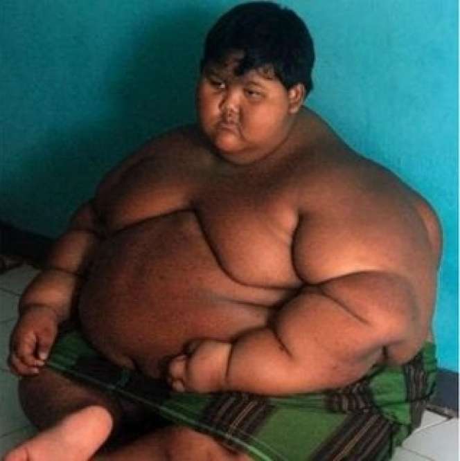 9 Potret Orang-Orang Obesitas yang Viral, Terakhir Paling Parah, Beberapa Sudah Meninggal Dunia!